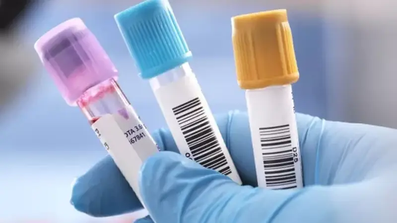 Blood sample vials