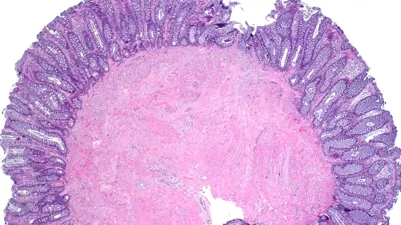 A whole-slide image of colon tissue under the microscope