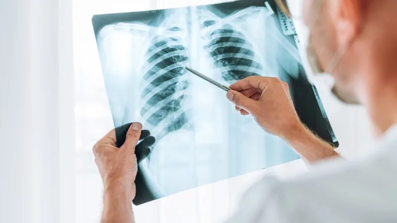Chest X-ray scan used in radiological examination.
