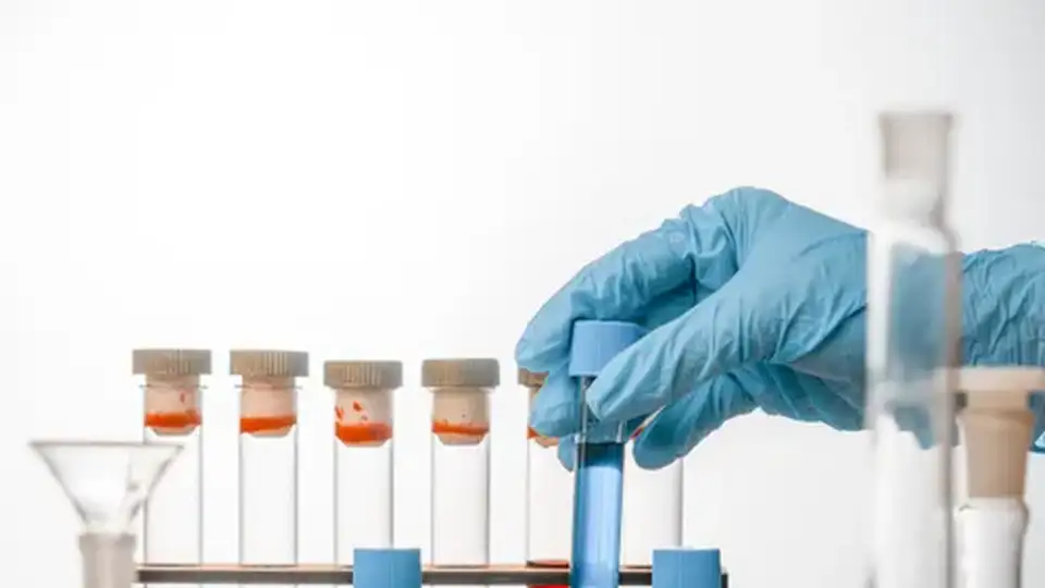 Test tubes filled with colored reagents in a laboratory
